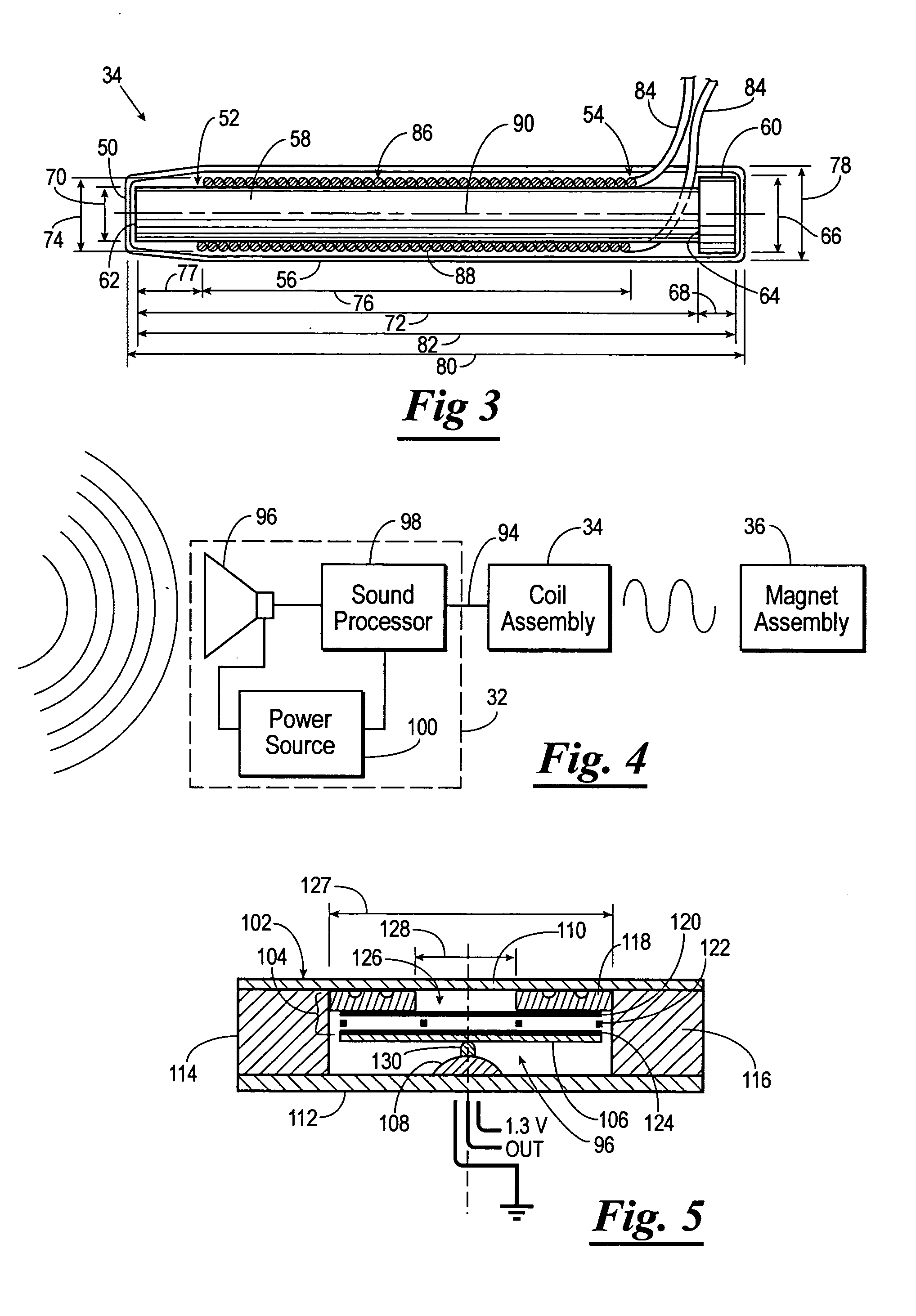 Totally implantable hearing system