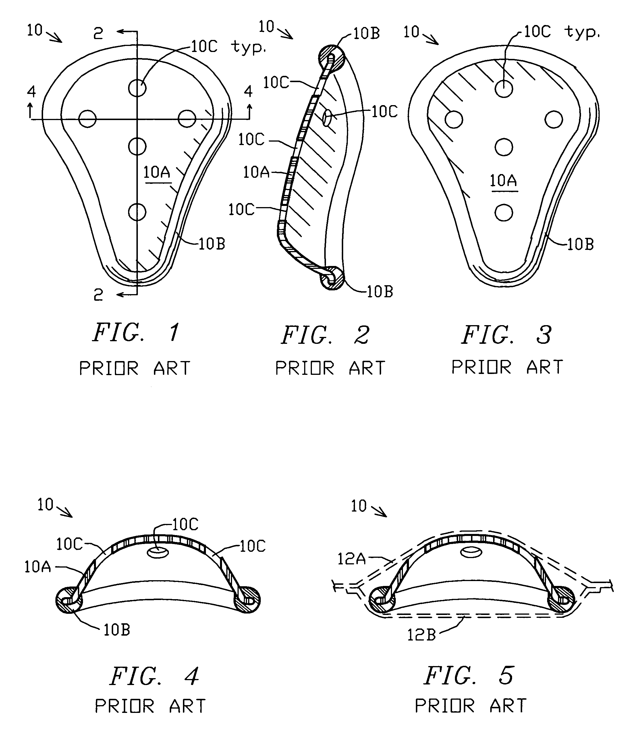 Male sports/athletic protective undergarment/cup system