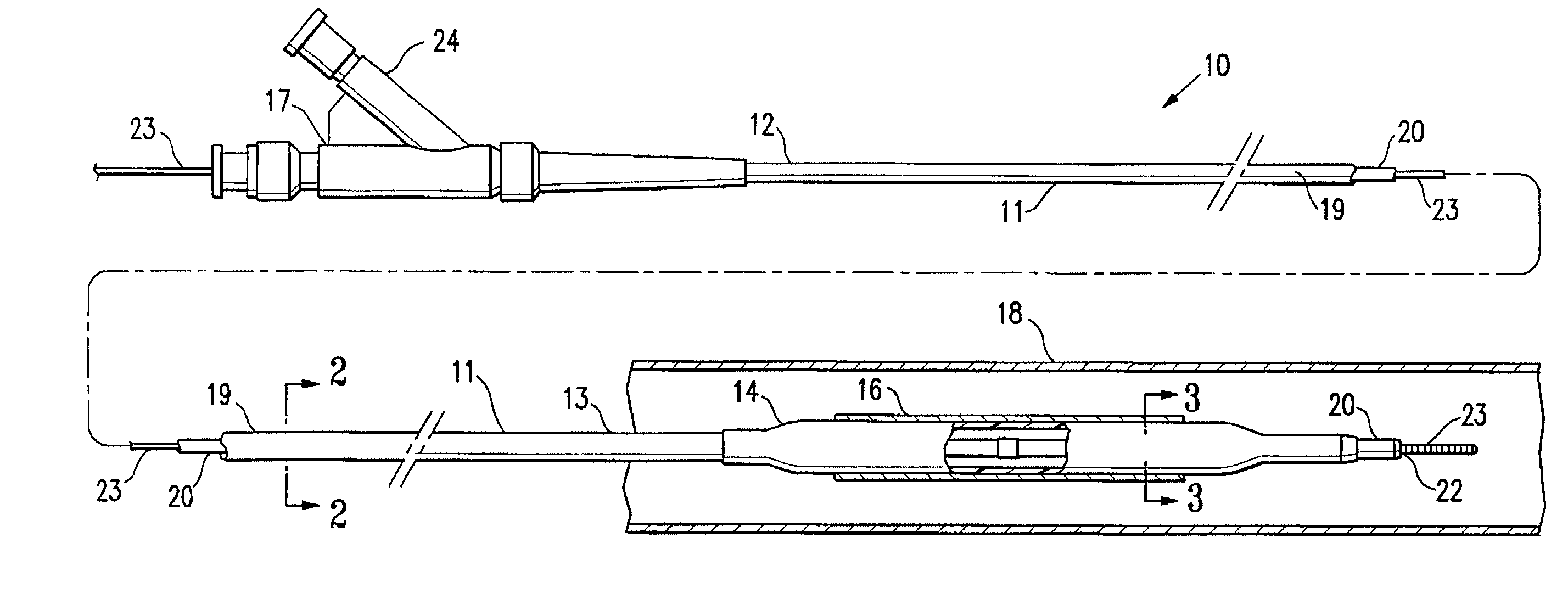 Method of sterilizing a medical device