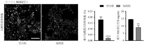 Application of enoxacin in prevention and/or treatment of flavivirus infection