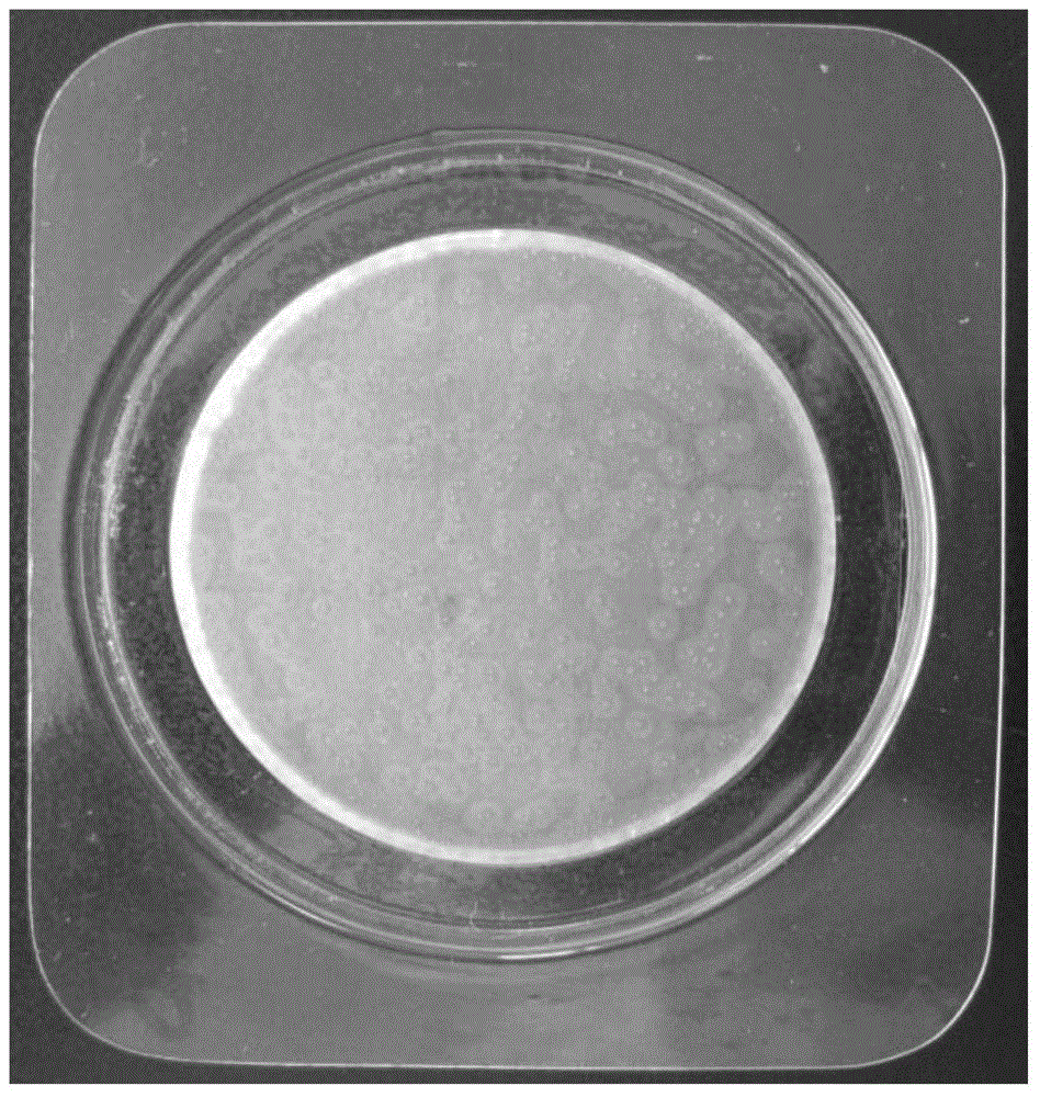 Transparent water-absorbing gel for microbial detection and detection plate