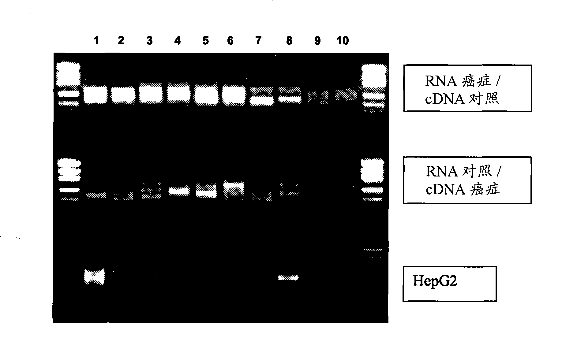 Method for detecting cancer