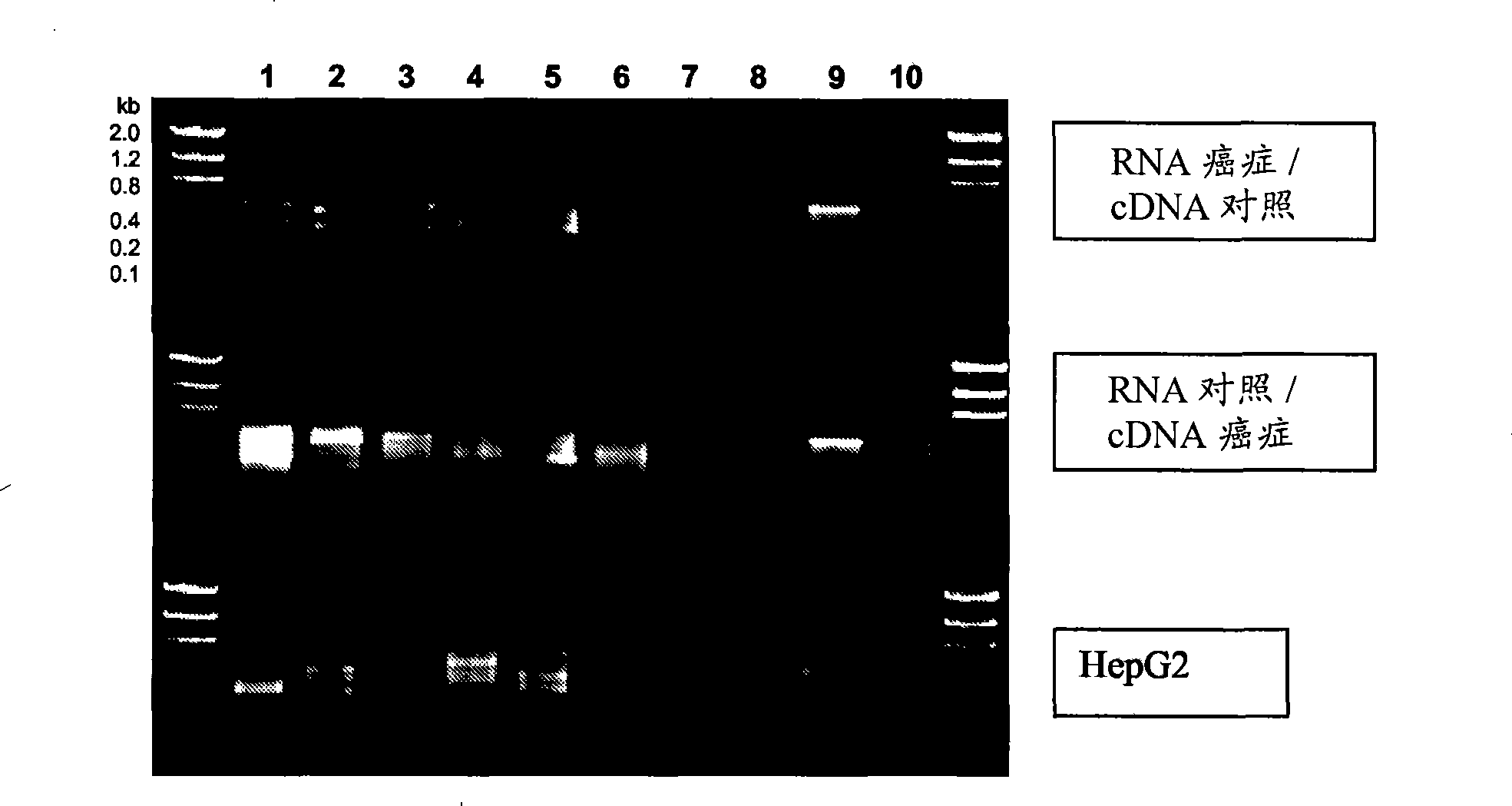 Method for detecting cancer