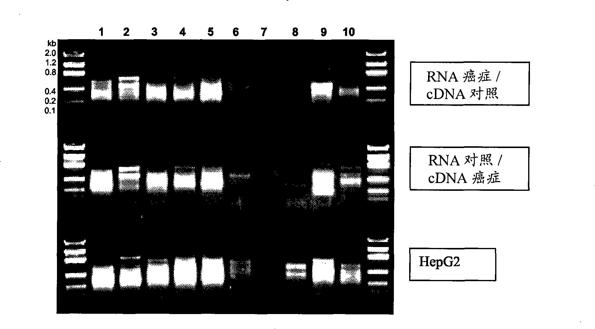 Method for detecting cancer