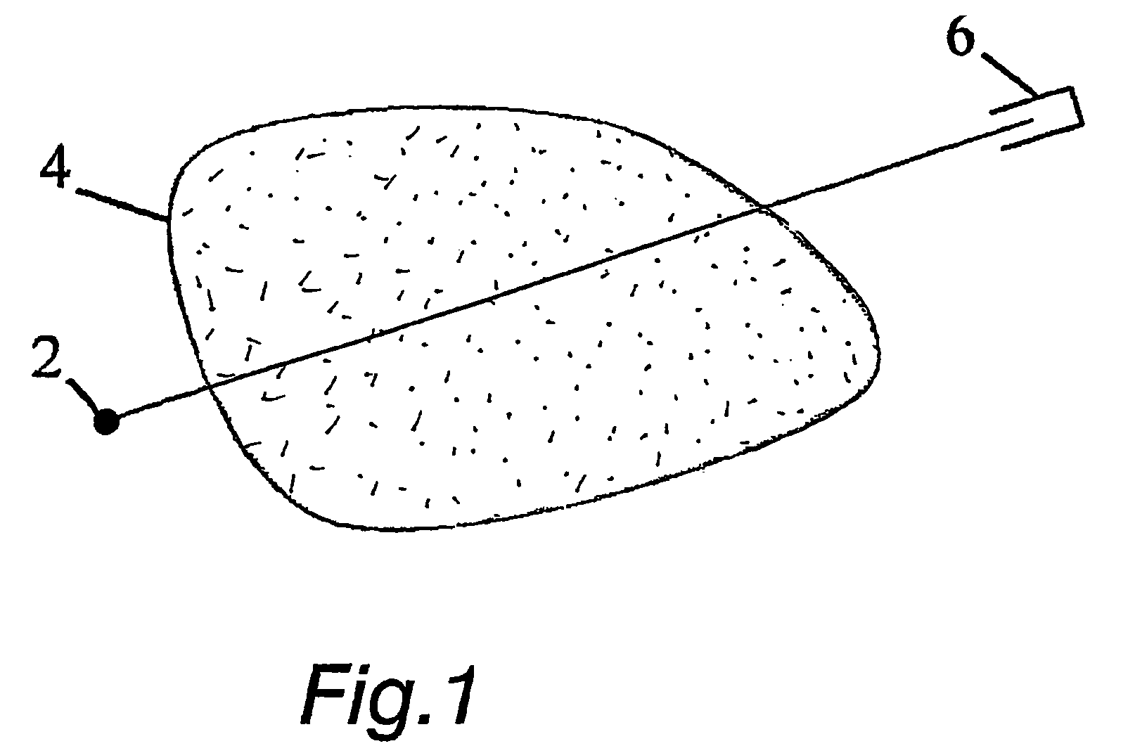 Method and arrangement for medical X-ray imaging and reconstruction from sparse data