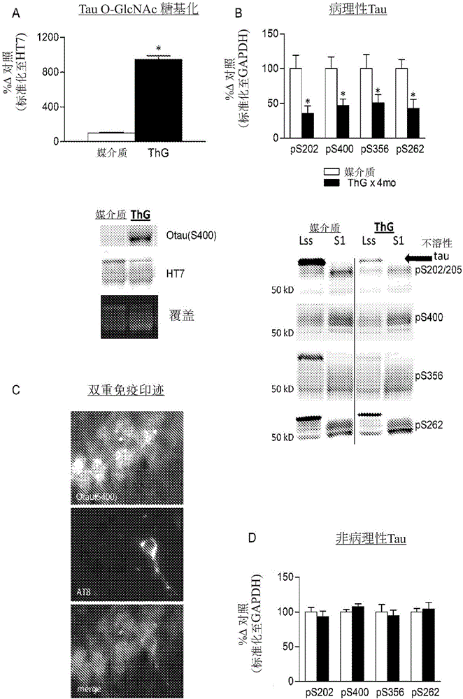 Glycosidase inhibitors