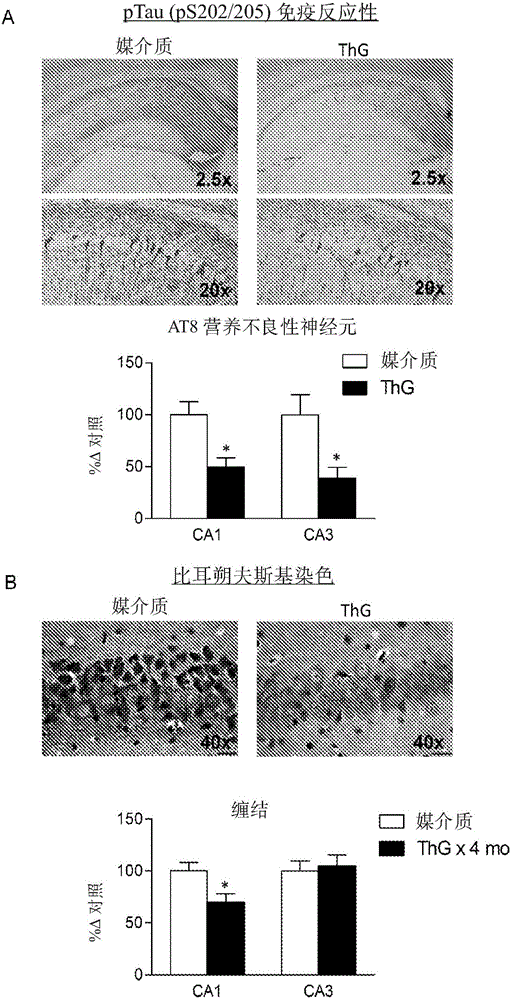 Glycosidase inhibitors