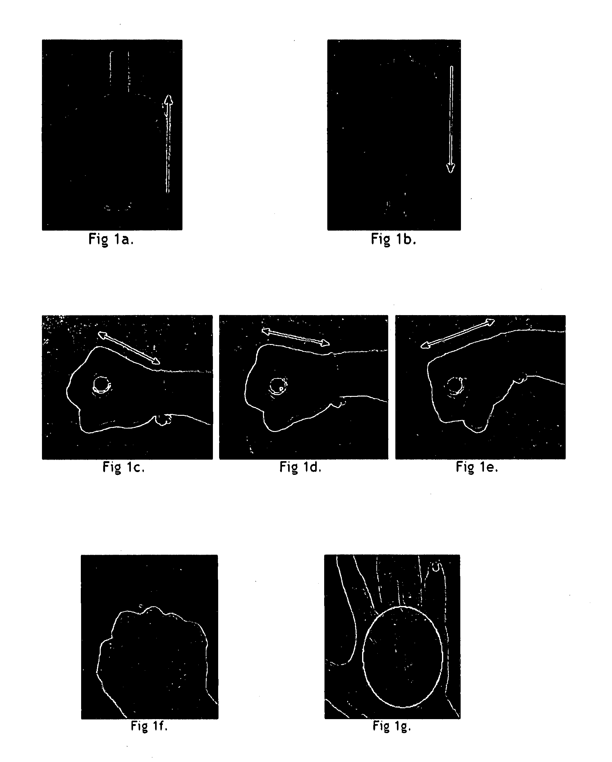 Vein pattern recognition based biometric system and methods thereof