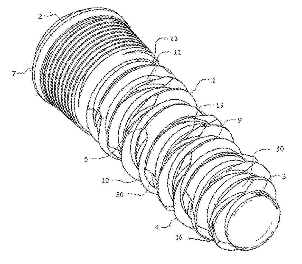 Self-clearing self-cutting implant