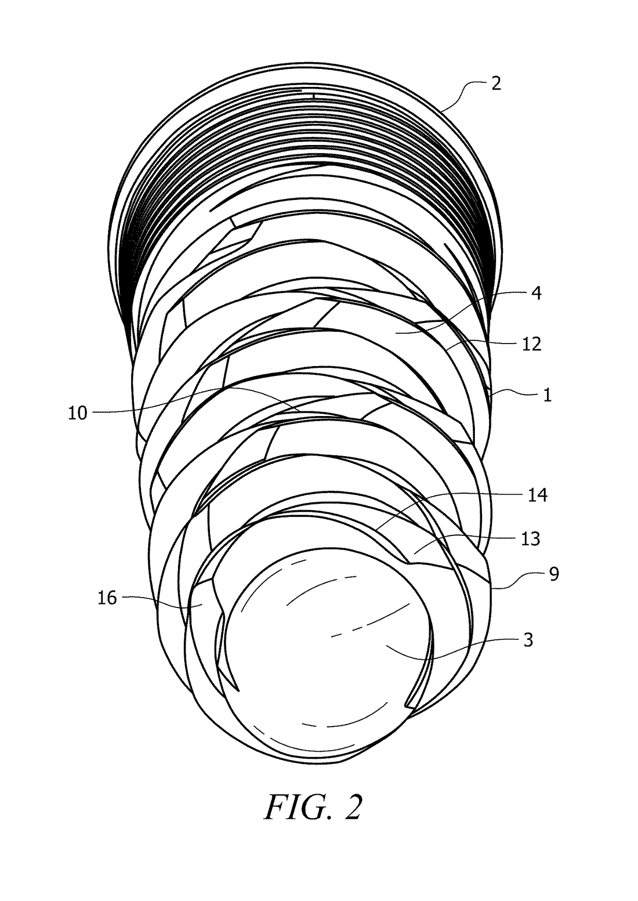 Self-clearing self-cutting implant