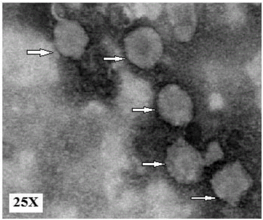 Porcine epidemic diarrhea virus monoclonal antibody, cell strain thereof and application