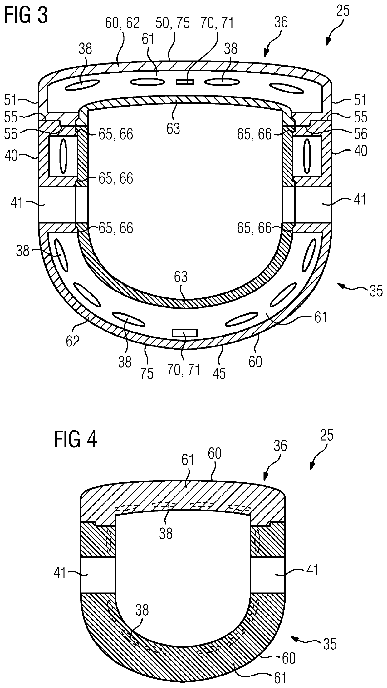 Local coil arrangement for use in an intervention supported by magnetic resonance imaging