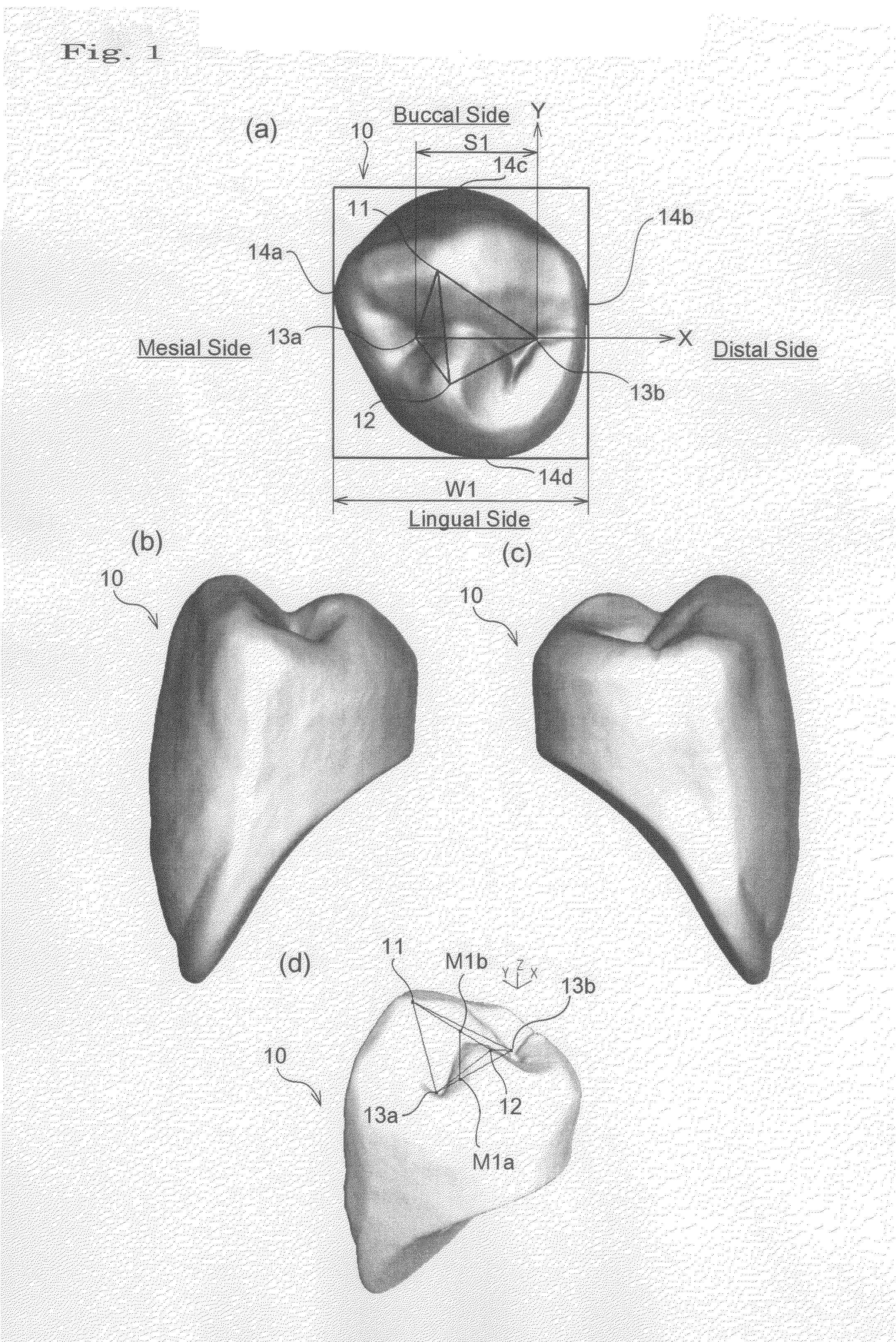 Artificial tooth