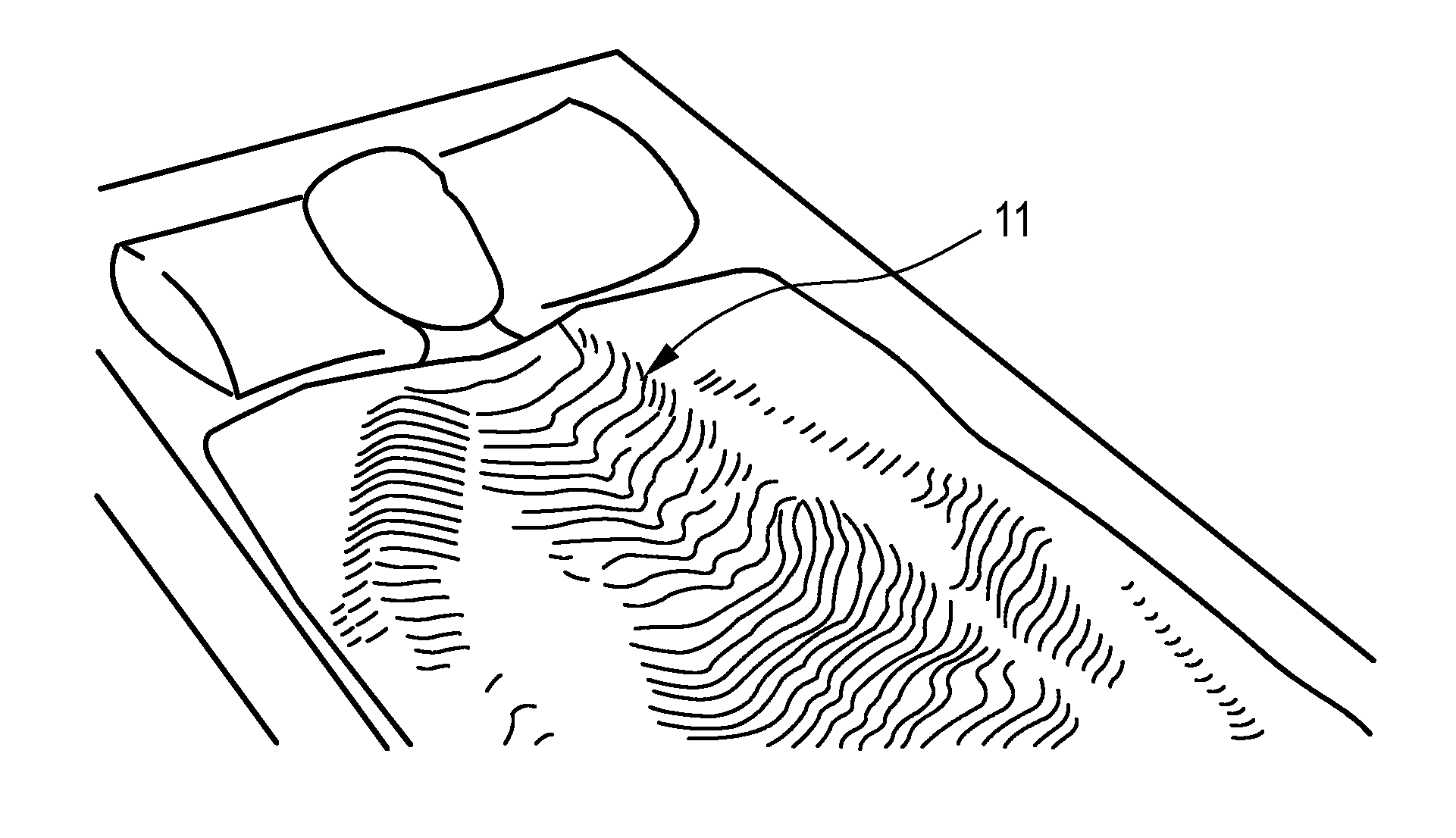 Respiratory motion detection apparatus