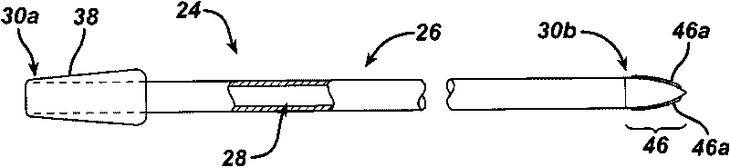 Methods and devices for performing gastrectomies and gastroplasties