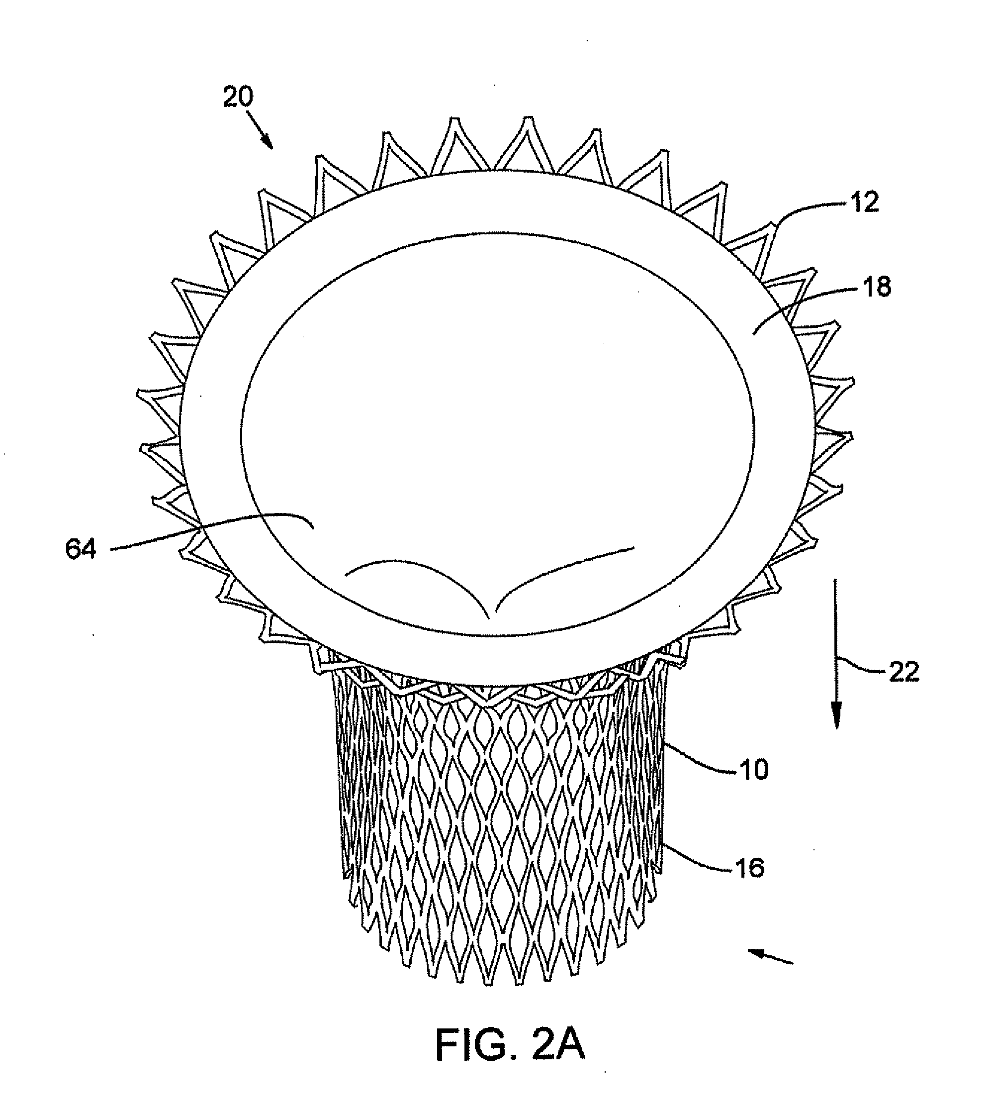 Device and method for replacing mitral valve