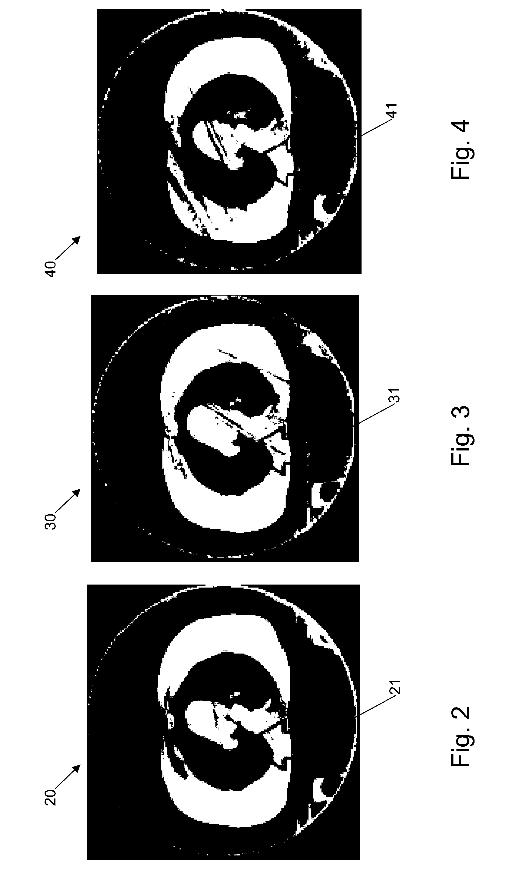 Optimised 4d cone beam computed tomography projection allocation