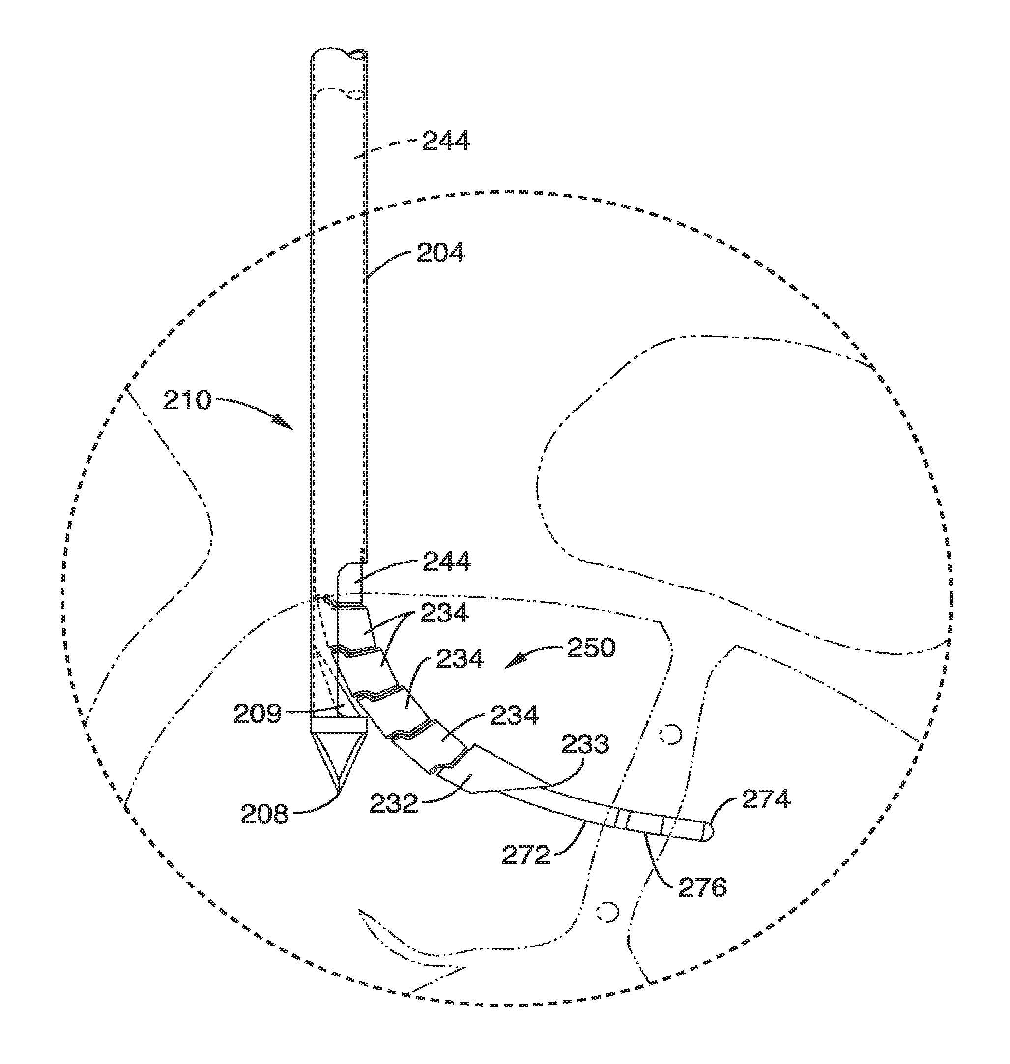 Vertebral treatment