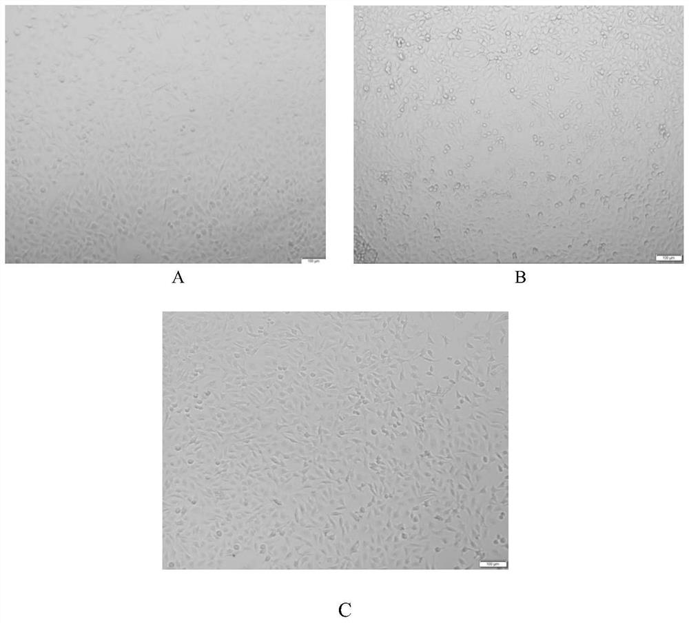 Lentinan soluble bean for improving intestinal immunity of children by diet and preparation method thereof