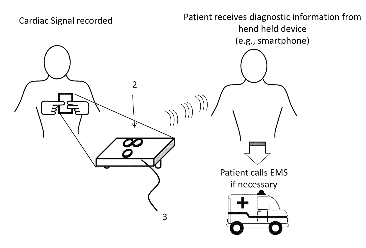 Mobile three-lead cardiac monitoring device and method for automated diagnostics