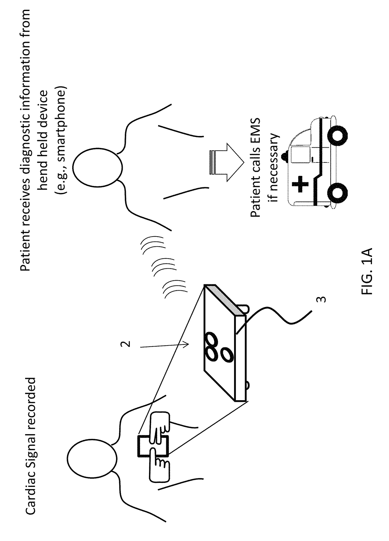 Mobile three-lead cardiac monitoring device and method for automated diagnostics