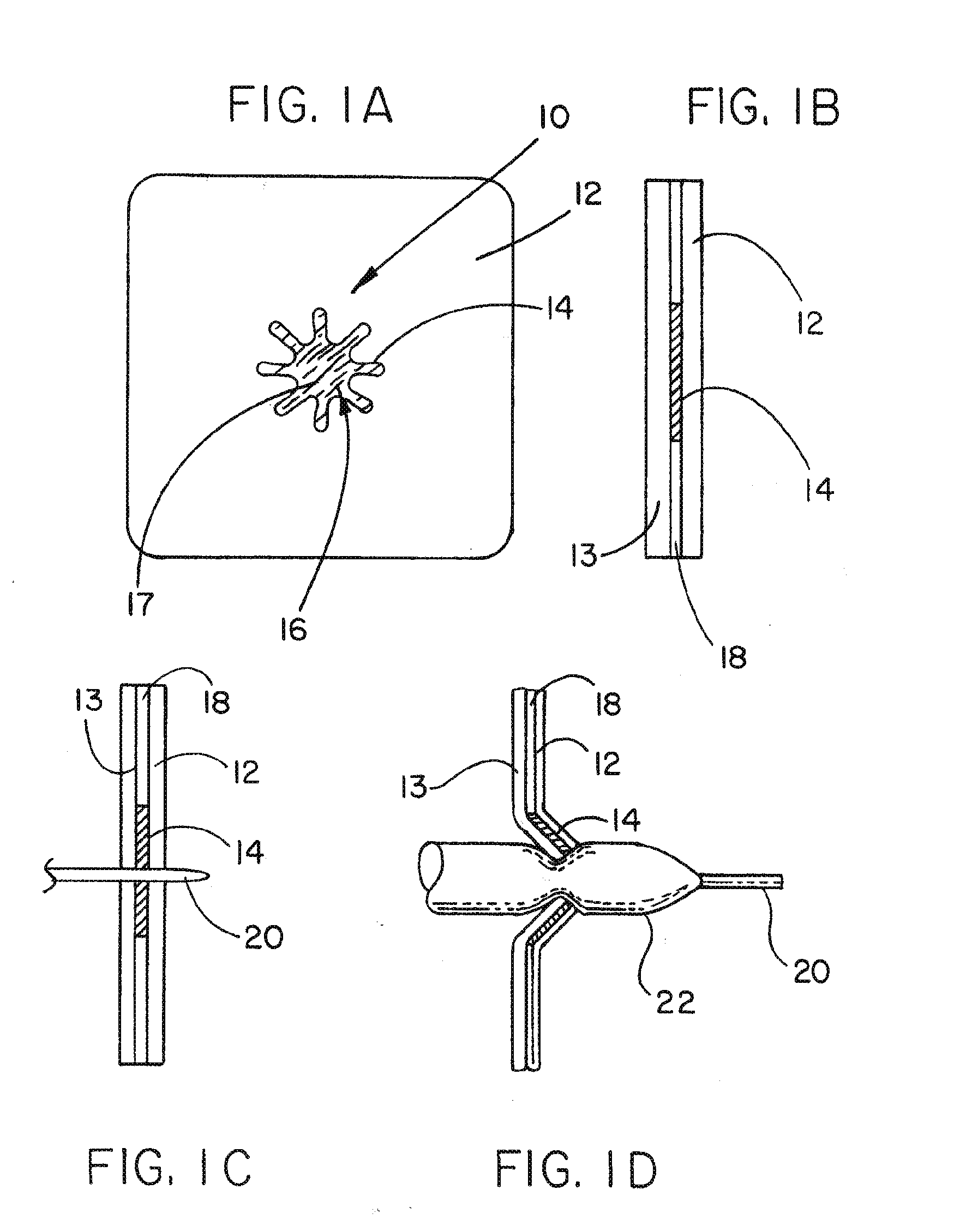 Medical device ameneable to fenestration