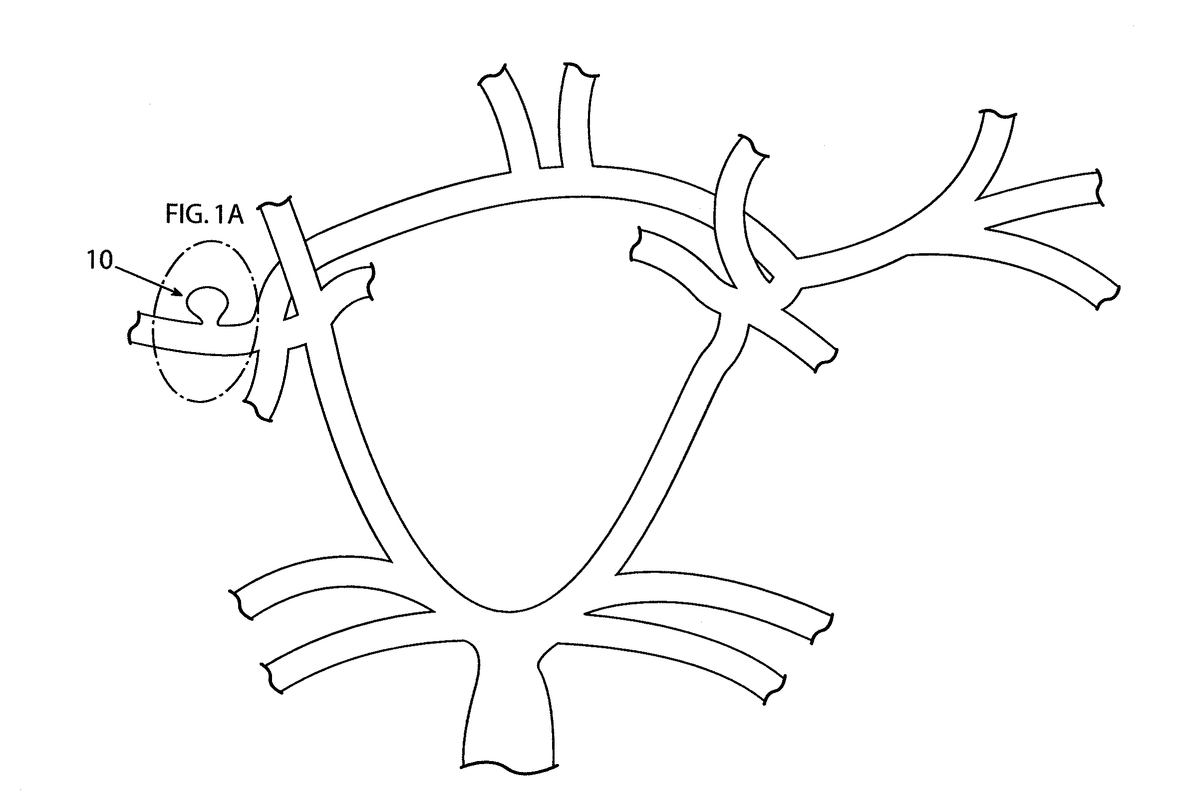 Devices and methods for occluding vascular abnormalities