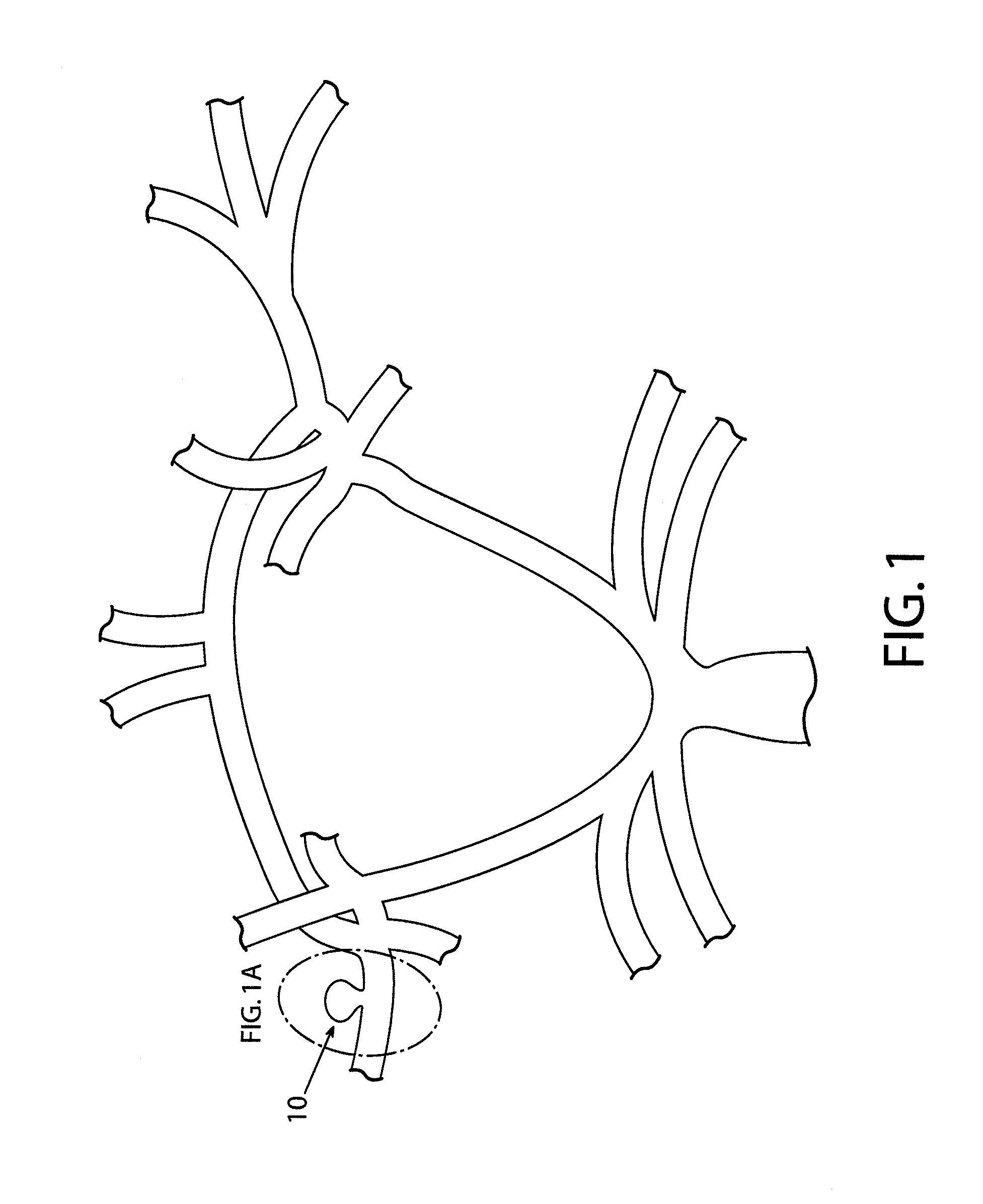 Devices and methods for occluding vascular abnormalities