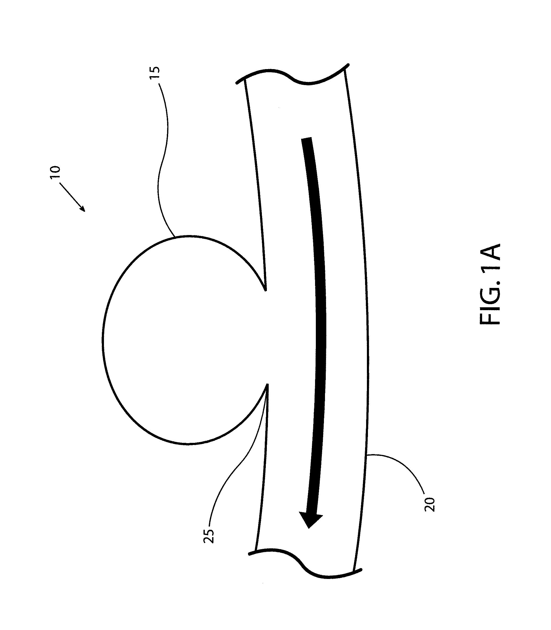 Devices and methods for occluding vascular abnormalities