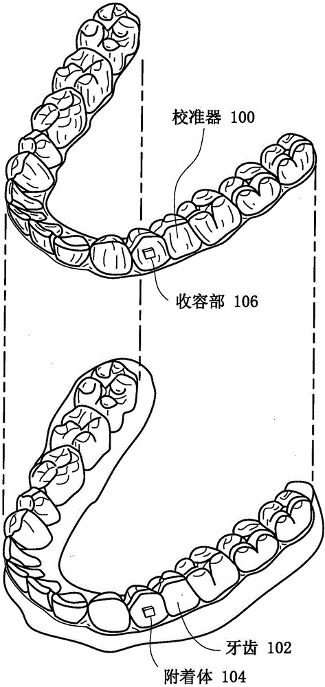 Segmented orthodontic appliance with elastics