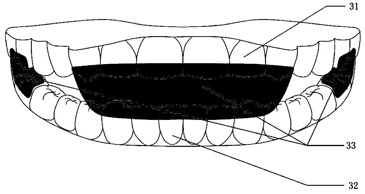 Forward re-positioning type snore guard and manufacturing method thereof