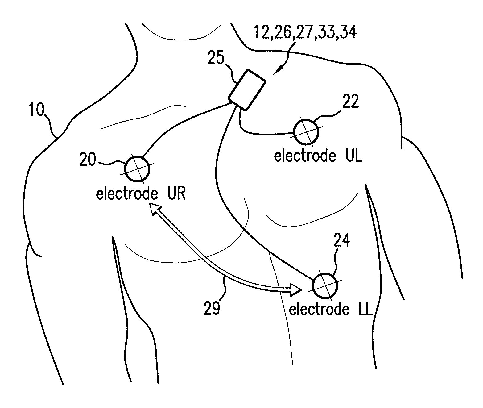 Body-worn monitor for measuring respiratory rate