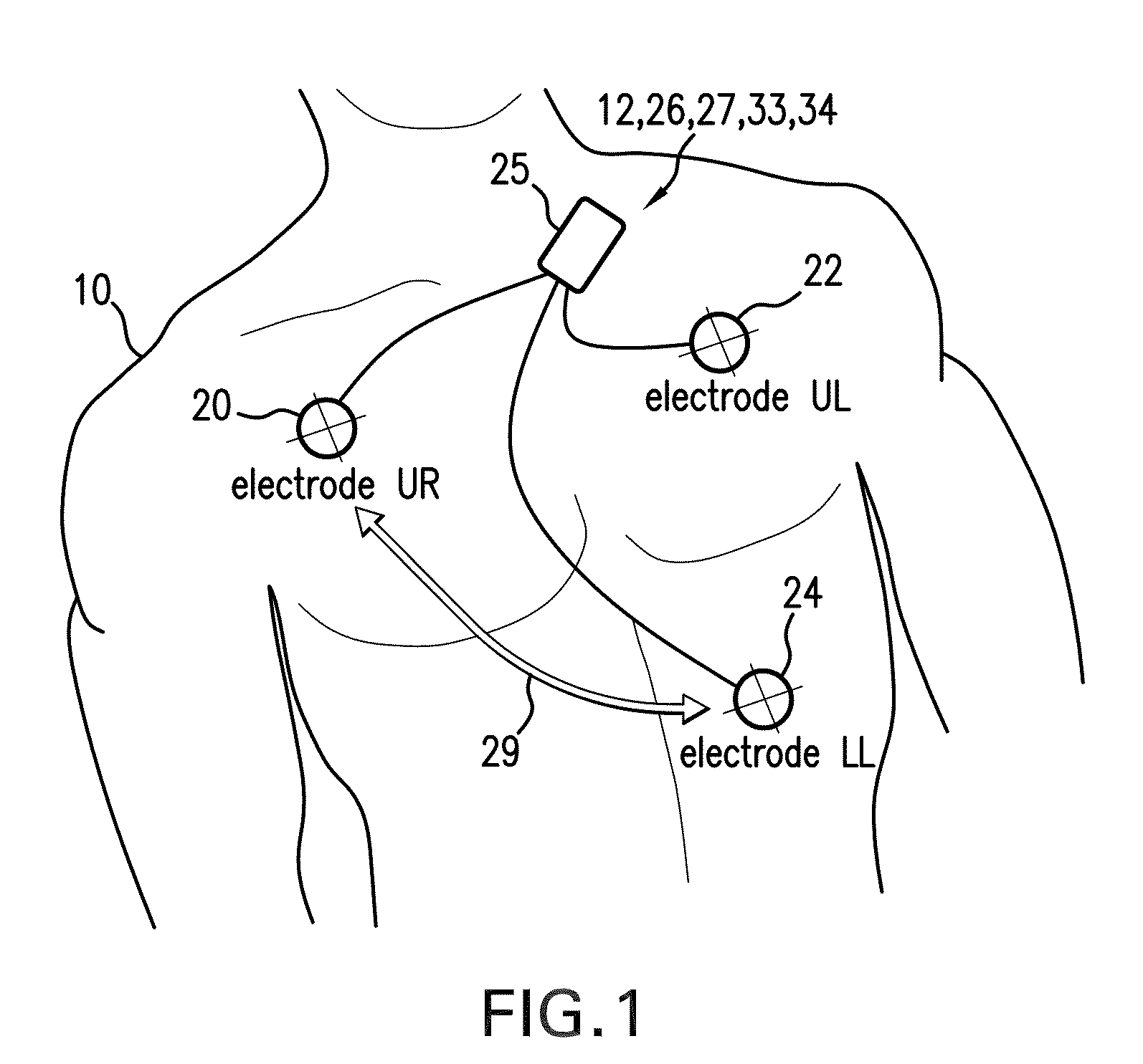 Body-worn monitor for measuring respiratory rate