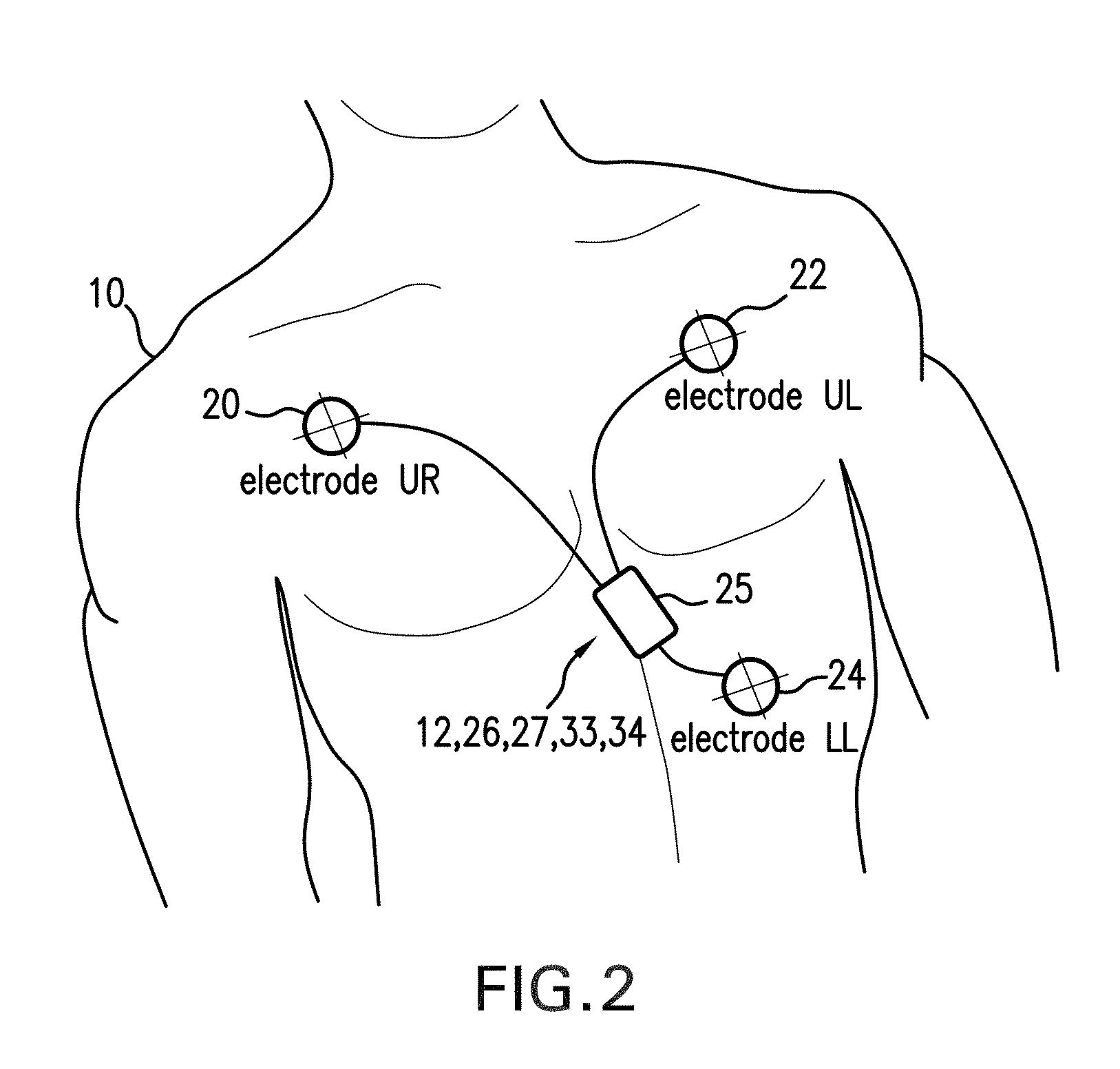 Body-worn monitor for measuring respiratory rate