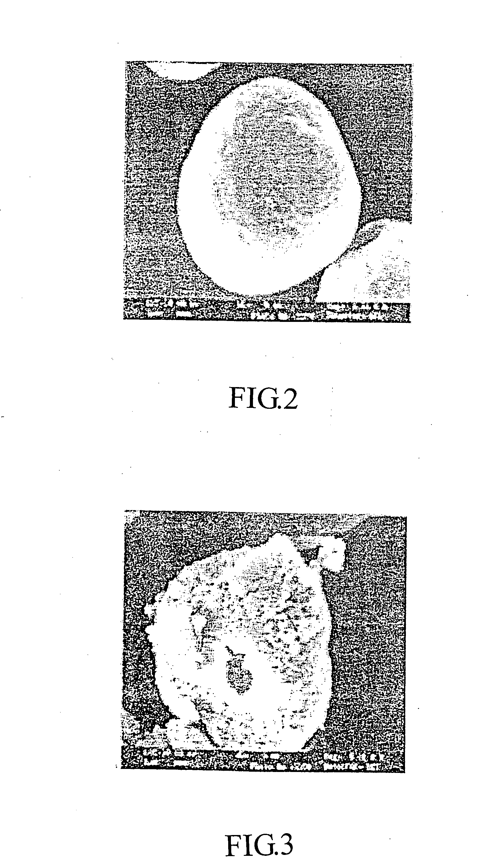 Probiotic composition having acid-resistant enteric coating