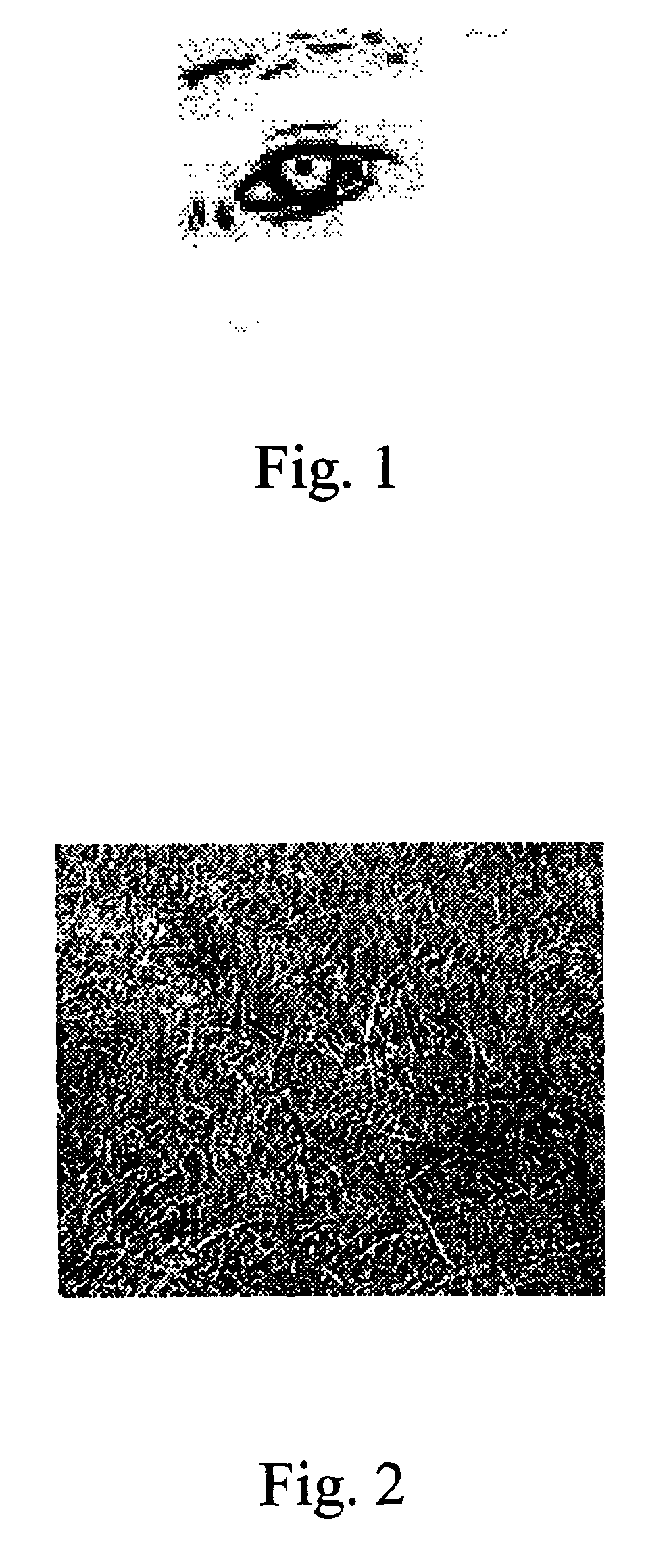 Human eye detection method, apparatus, system and storage medium