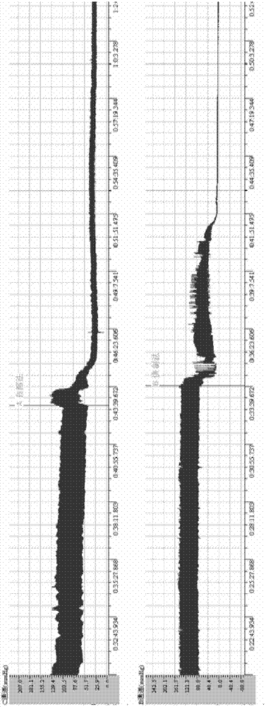 Preparation method of jellyfish cardiovascular toxin crude extract