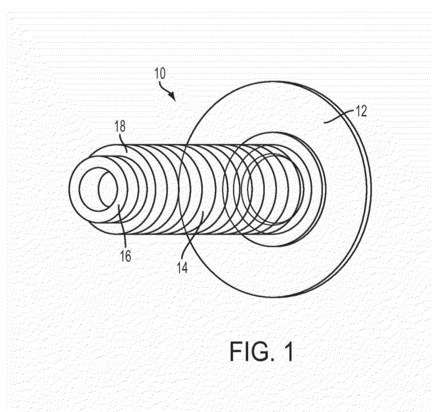 Catheter Extension With Integrated Circumferentially Sealing Securement Dressing