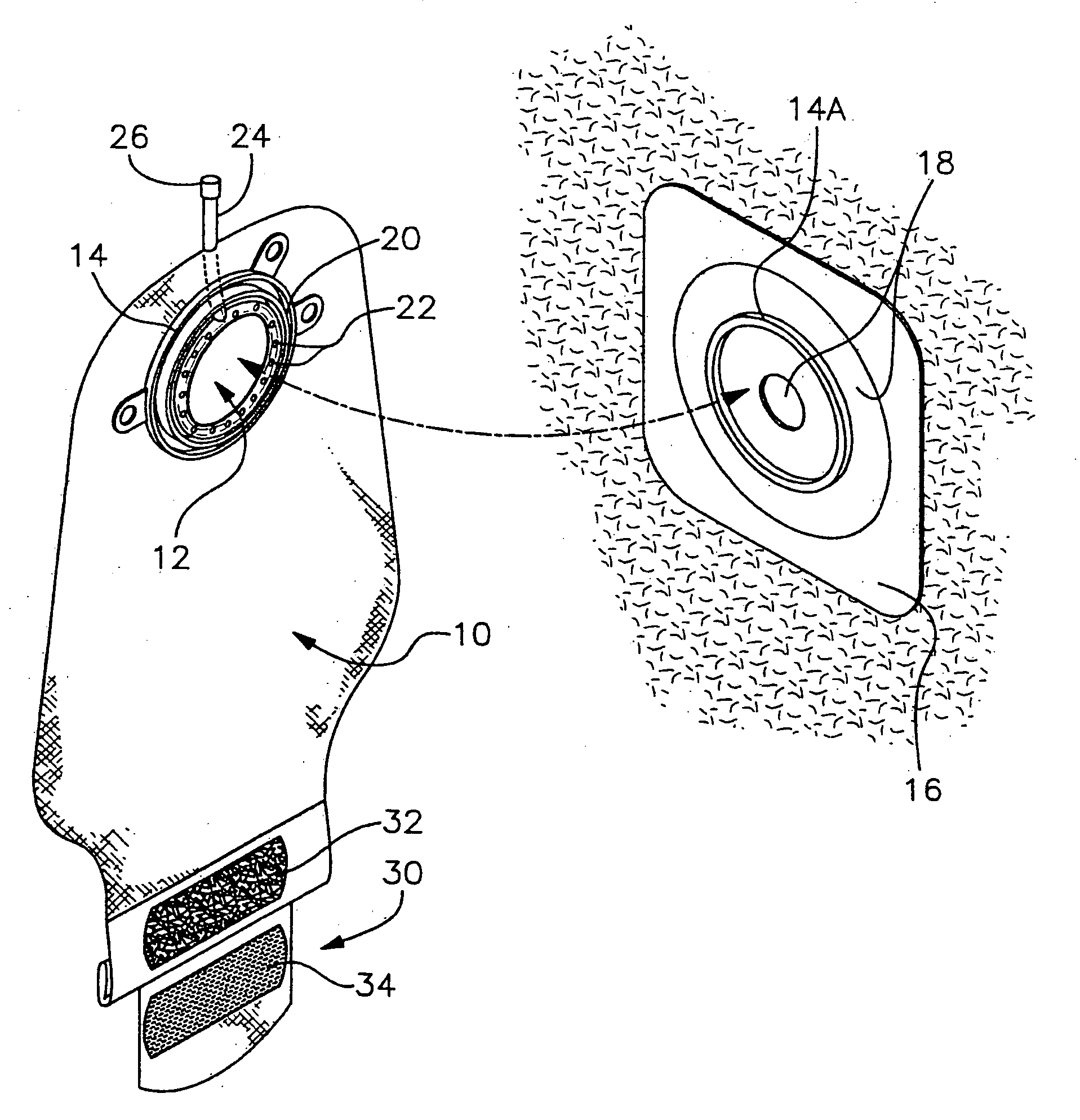 Colostomy bag cleaning system