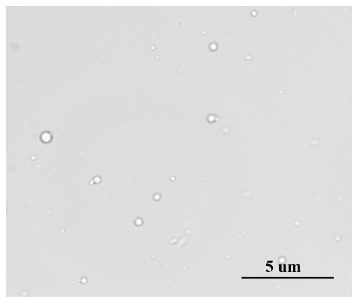 Application of chitosan nanoscale ultrasound contrast agent combined with dickkopf-2 gene in the preparation of drugs for the treatment of prostate cancer