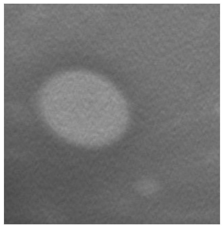 Application of chitosan nanoscale ultrasound contrast agent combined with dickkopf-2 gene in the preparation of drugs for the treatment of prostate cancer