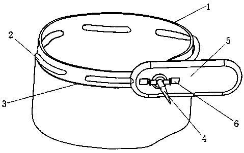 Intestinal stoma reduction protector