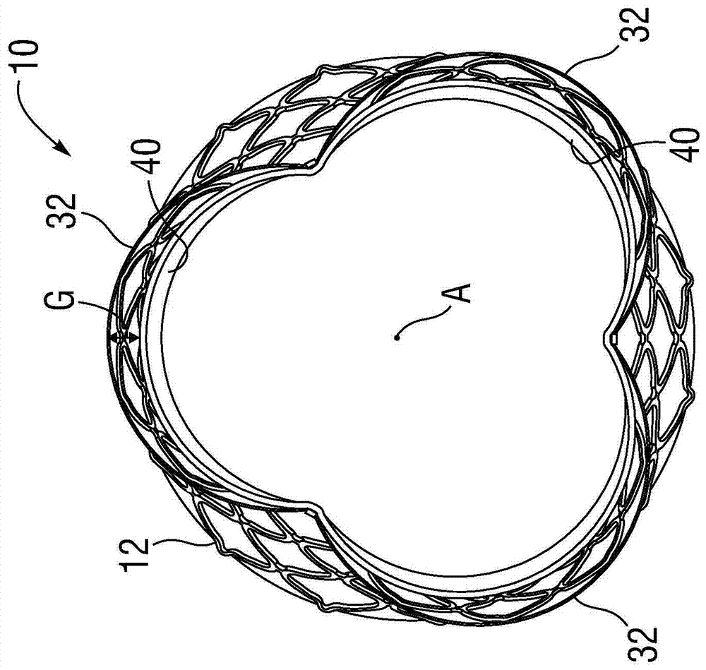 Prosthetic heart valve with improved commissural support