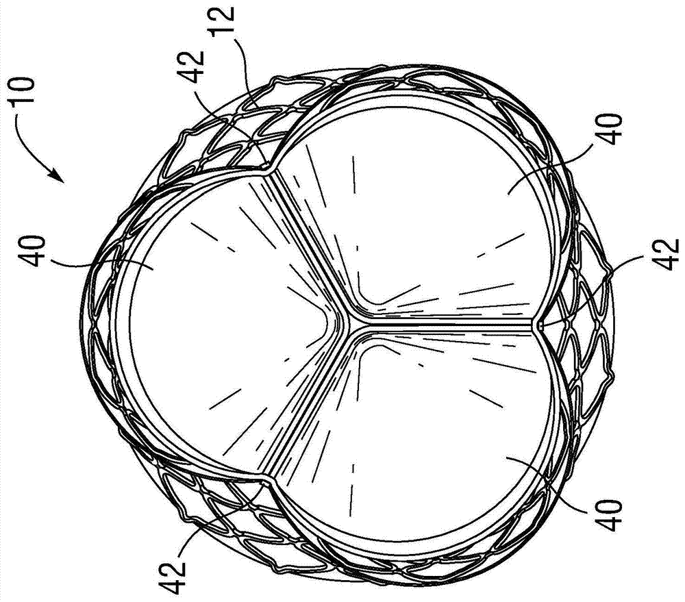 Prosthetic heart valve with improved commissural support