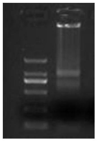 Gene for improving cyst nematode resistance of soybeans and application of gene