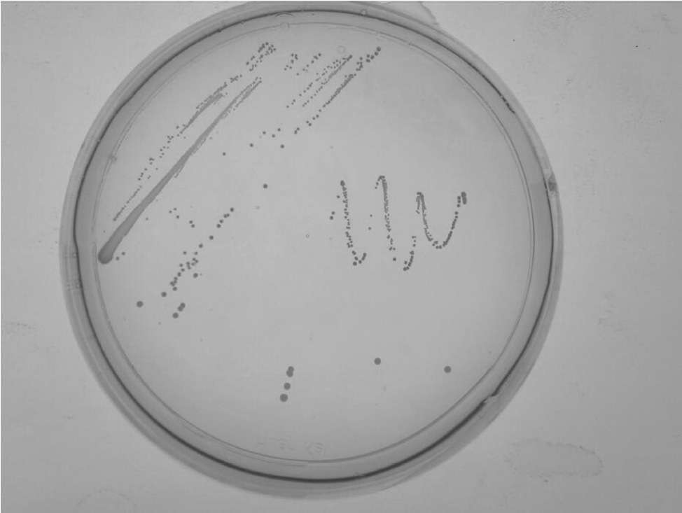 A strain of Methylobacterium and its fermentation product and its application in inhibiting the growth of algae