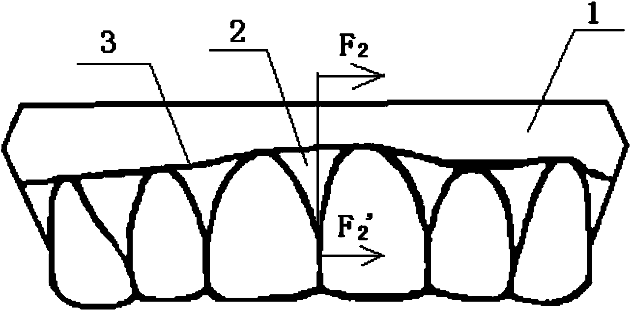 Bracketless invisible appliance and manufacturing method thereof