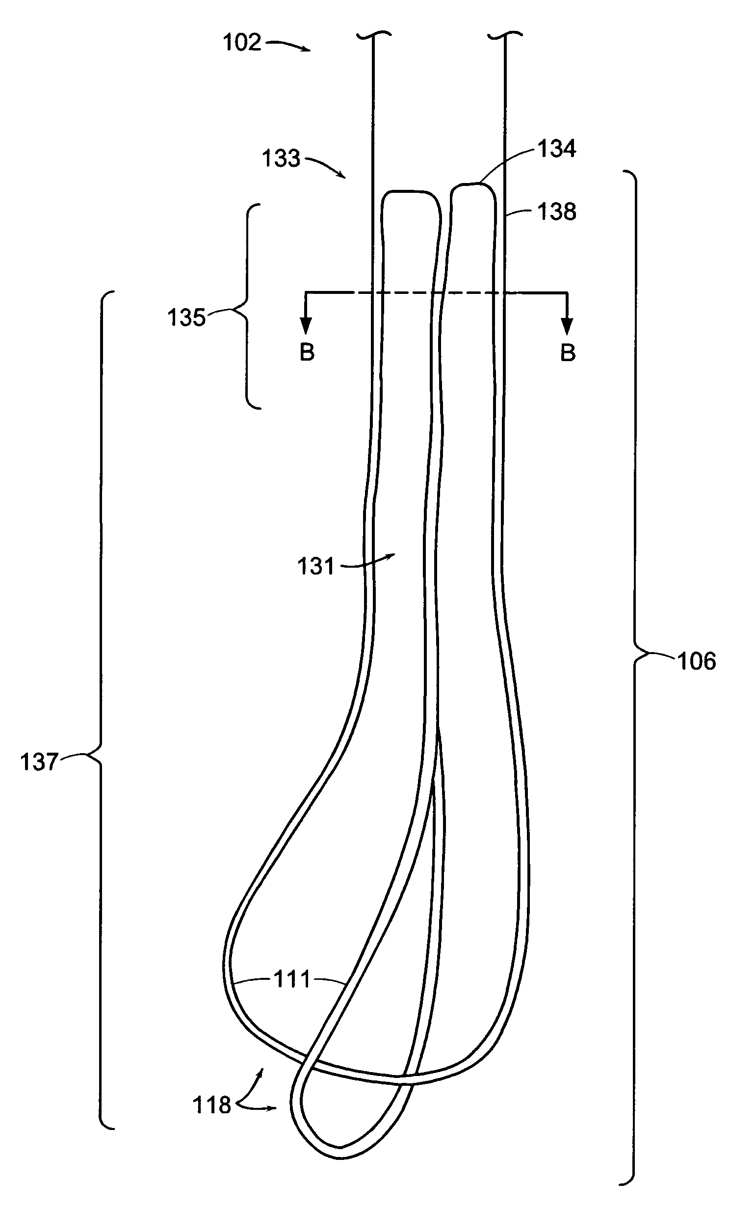 Ureteral stent for improved patient comfort