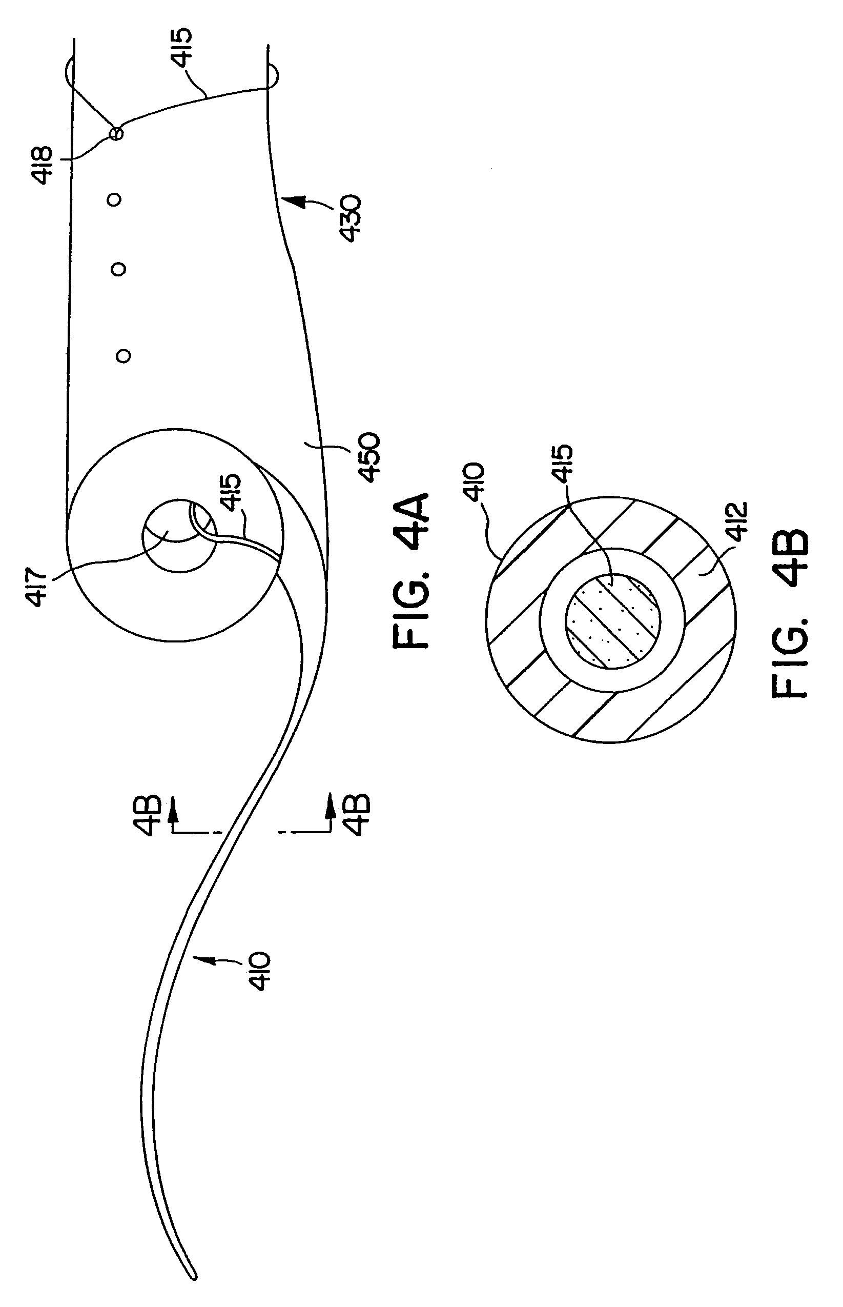 Ureteral stent for improved patient comfort