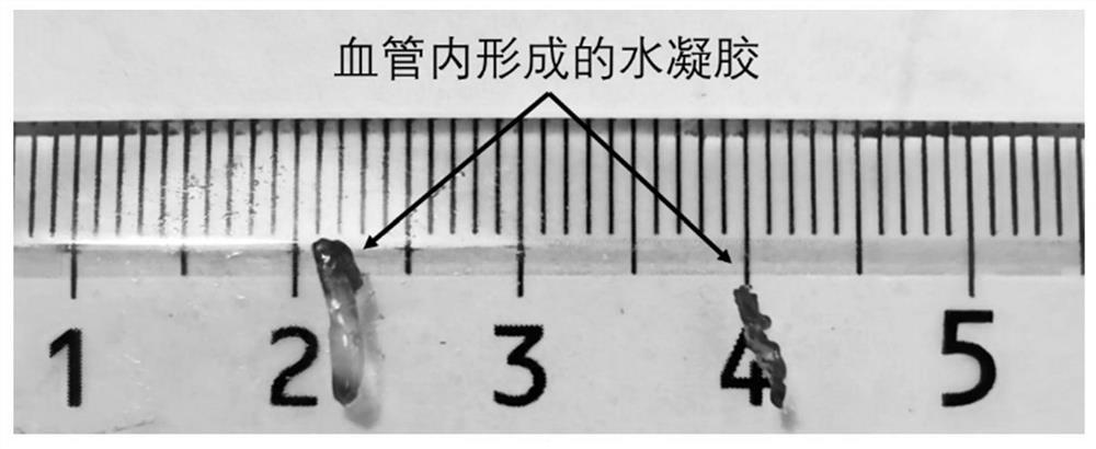 Injectable hydrogels for vascular embolism